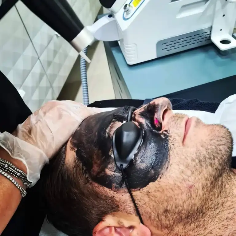 Mască neagră aplicată în cadrul unui tratament facial